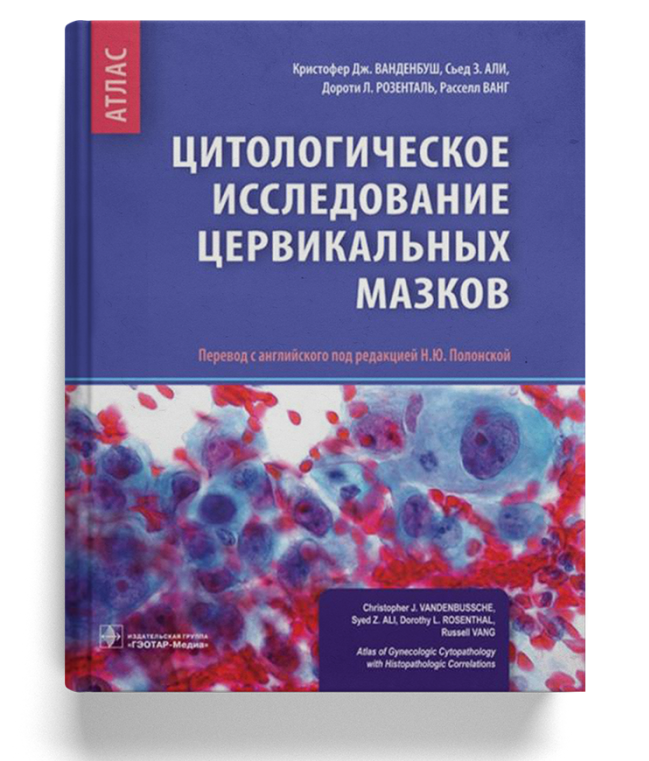 Цитологическое исследование цервикальных мазков: атлас 