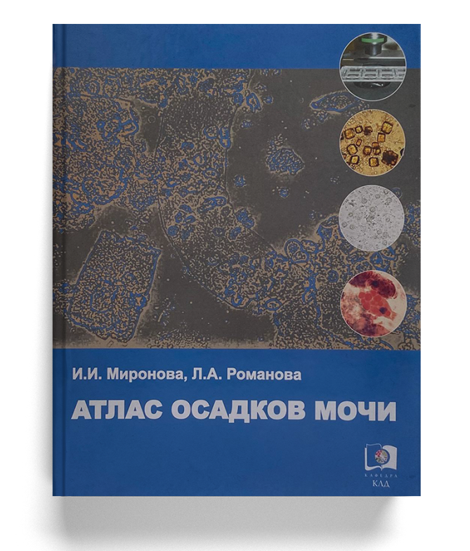 Атлас осадков мочи